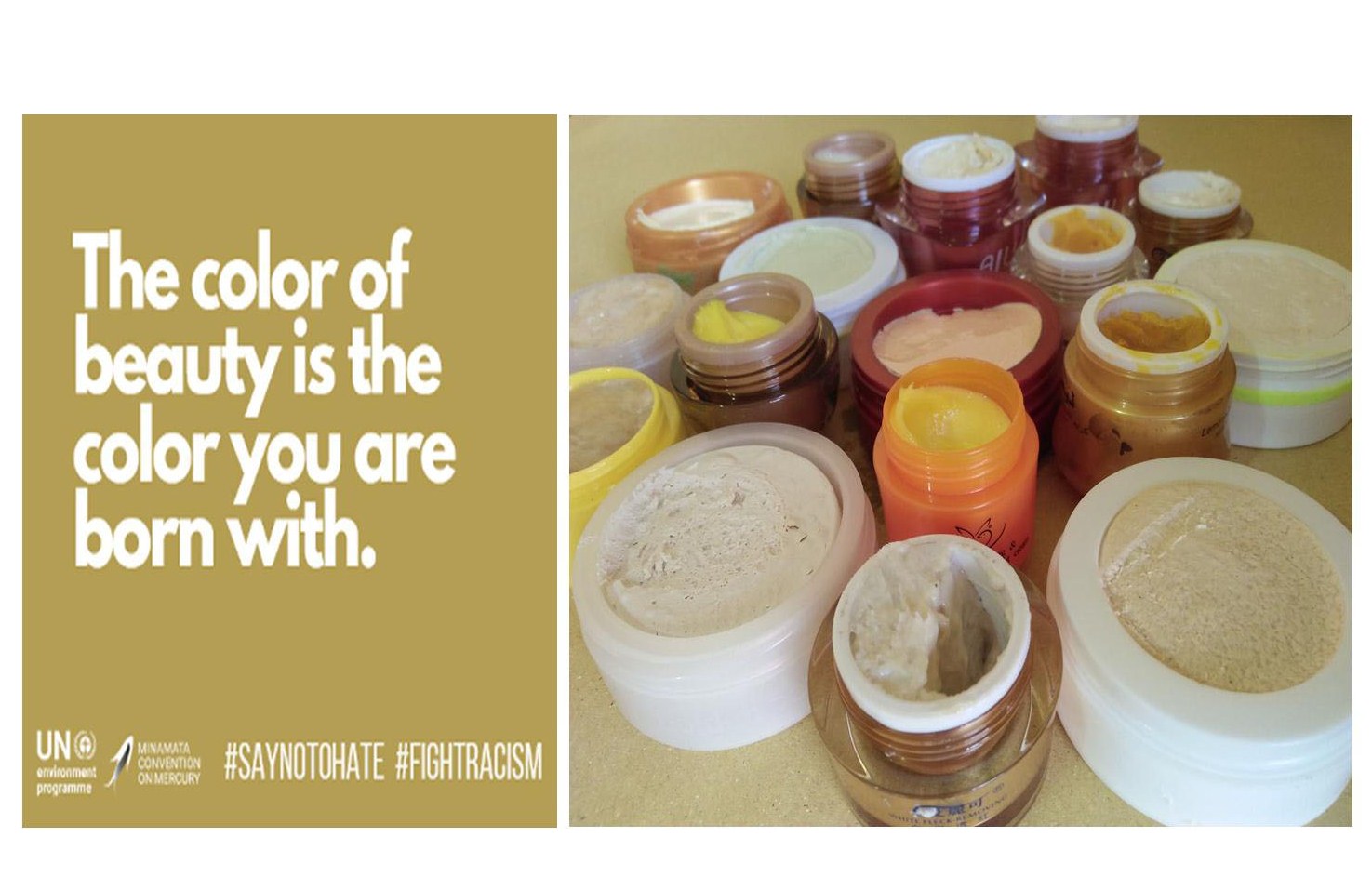 EcoWaste Coalition Reminds Filipinos: True Radiance Comes from Within, Not from Mercury