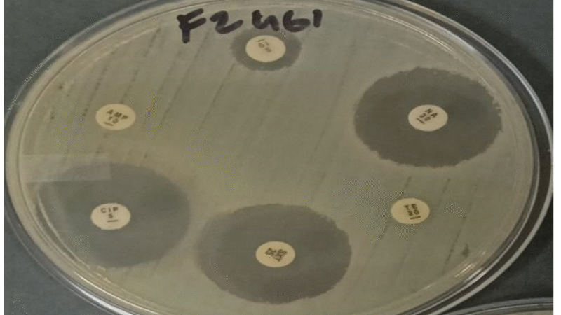 UP Researchers Predict Antimicrobial Resistance Using AI Models