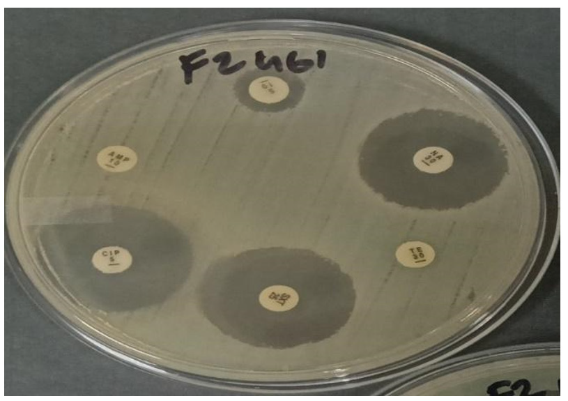UP Researchers Predict Antimicrobial Resistance Using AI Models